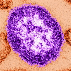 Toronto reports 4 unlinked measles cases; none travelled, means more out there | iNFOnews.ca