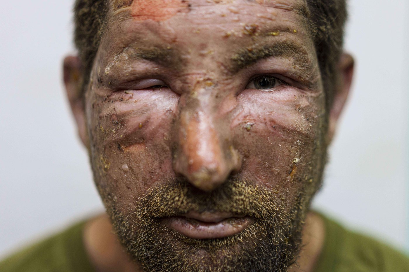 High-tech drones turn Ukraine's front line into a deadly kill zone, complicating evacuations | iNFOnews.ca