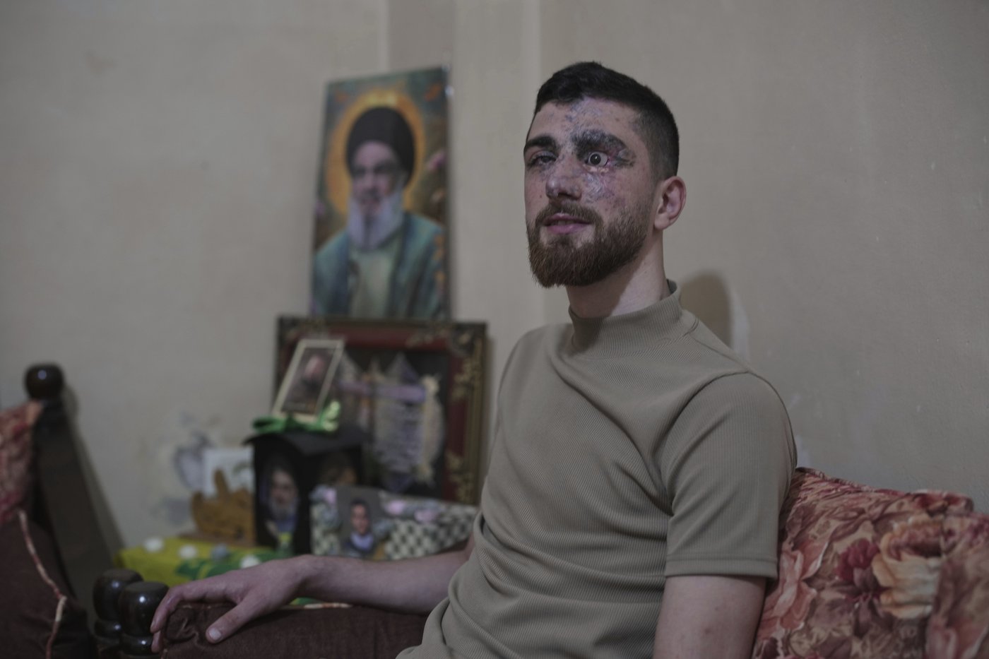 Survivors of Israel's pager attack on Hezbollah last year struggle to recover | iNFOnews.ca Survivors of Israel's pager attack on Hezbollah last year struggle to recover | iNFOnews.ca