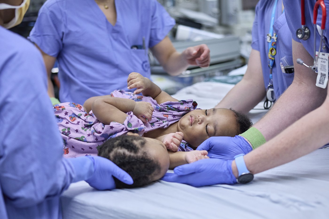 Twin boys born conjoined celebrate 1st birthday after separation surgery | iNFOnews.ca Twin boys born conjoined celebrate 1st birthday after separation surgery | iNFOnews.ca