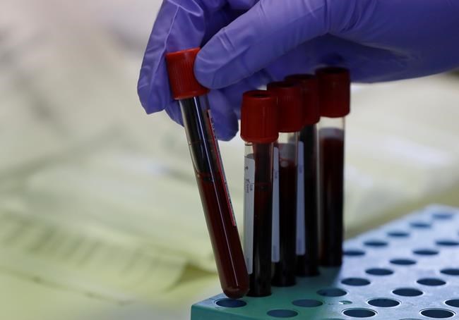 COVID-19 task force worries Trump's rush to approve vaccine will spook Canadians | iNFOnews.ca COVID-19 task force worries Trump's rush to approve vaccine will spook Canadians | iNFOnews.ca