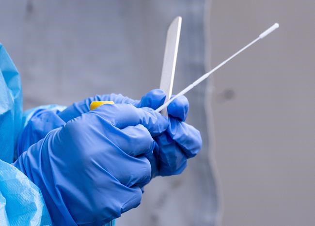 First antigen rapid test for COVID-19 gets Canadian approval | iNFOnews.ca First antigen rapid test for COVID-19 gets Canadian approval | iNFOnews.ca