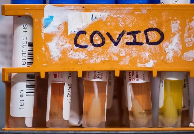 'It only takes one:' COVID-19 cases continue to surge among First Nations in Manitoba | iNFOnews.ca 'It only takes one:' COVID-19 cases continue to surge among First Nations in Manitoba | iNFOnews.ca
