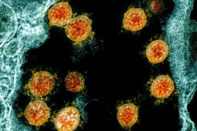 COVID-19 outbreak closes one unit of Vancouver General Hospital to admissions, visits | iNFOnews.ca CP1957686285