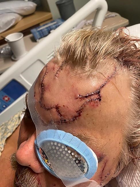 10 seconds of terror: Alaska man survives brown bear mauling | iNFOnews.ca