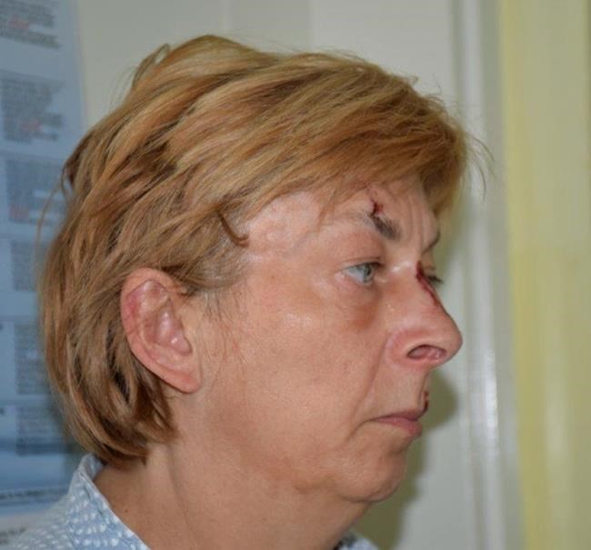 Croatia police trying to identify woman with memory loss | iNFOnews.ca CP1956389725