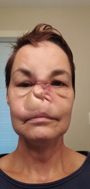 Saskatchewan woman who was scared after Alberta surgery cancelled says it is back on | iNFOnews.ca