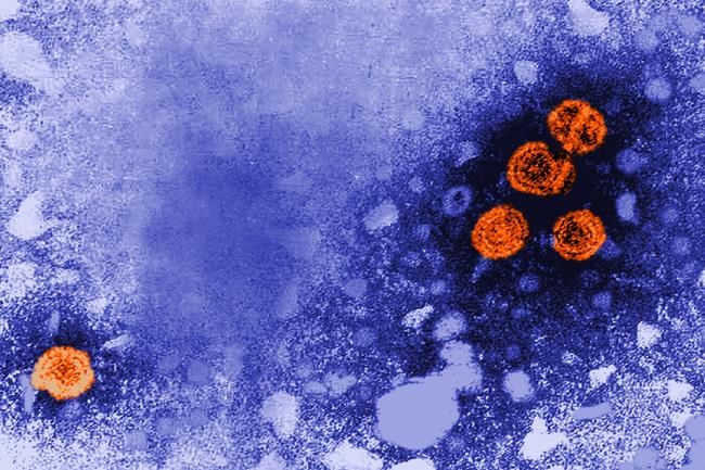 Panel: All US adults under 60 should get hepatitis B shots | iNFOnews.ca CP2005373576
