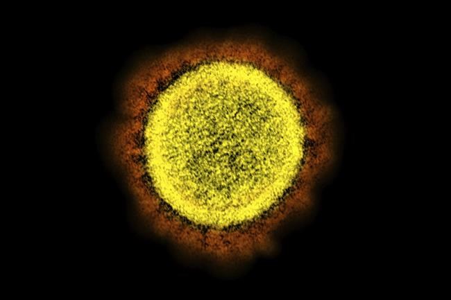 As 'stealth omicron' advances, scientists are learning more | iNFOnews.ca