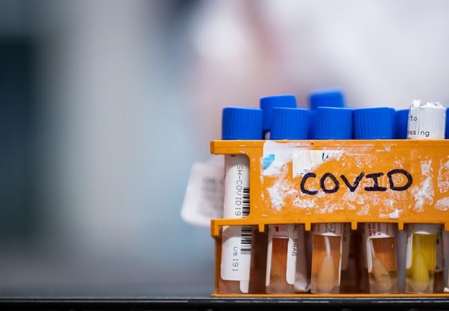 Canada's COVID-19 infections among adults tripled in early 2022 due to Omicron: study | iNFOnews.ca Canada's COVID-19 infections among adults tripled in early 2022 due to Omicron: study | iNFOnews.ca