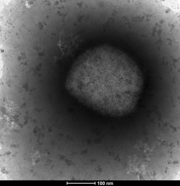 First B.C. monkeypox case is confirmed in Vancouver resident | iNFOnews.ca