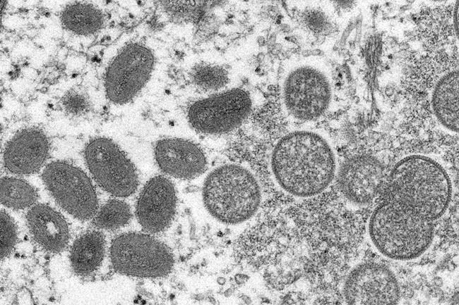 African officials: Monkeypox spread is already an emergency | iNFOnews.ca