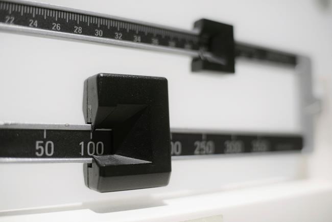 Health officials revise tool to track severe obesity in kids | iNFOnews.ca
