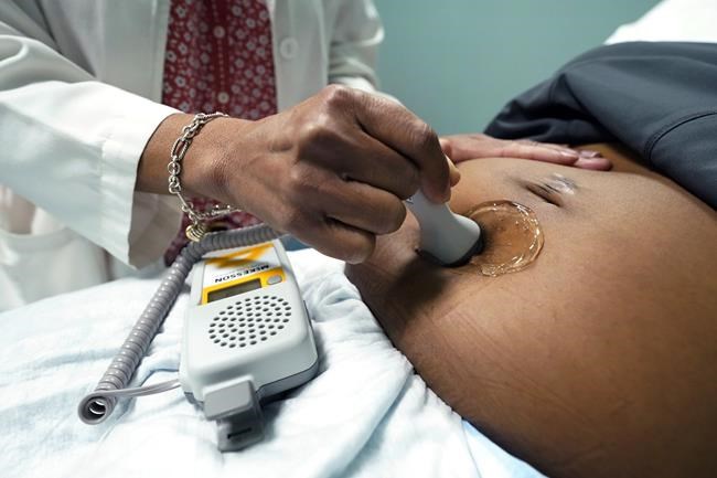 Louisiana bill seeks 'fairness' in pregnancy costs | iNFOnews.ca