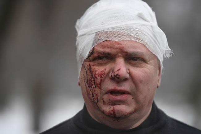 Ukraine strike deaths hit 40; Russia seen preparing long war | iNFOnews.ca Ukraine strike deaths hit 40; Russia seen preparing long war | iNFOnews.ca