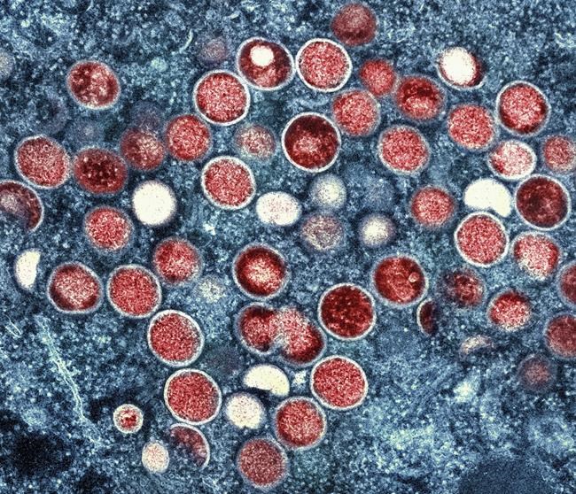 Africa CDC expects Mpox vaccines to arrive within 2 weeks | iNFOnews.ca Africa CDC expects Mpox vaccines to arrive within 2 weeks | iNFOnews.ca