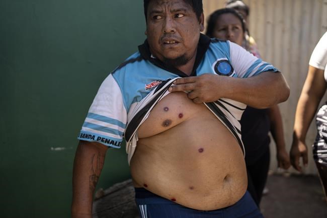 Argentina: Police arrest suspect in killing of 11-year-old | iNFOnews.ca Argentina: Police arrest suspect in killing of 11-year-old | iNFOnews.ca