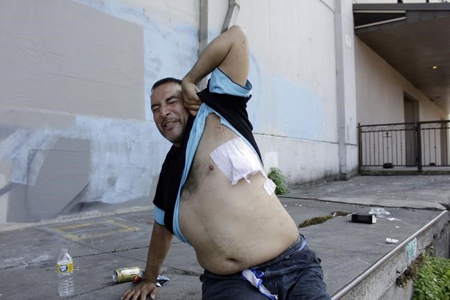 Gun injuries in US surged during pandemic, CDC study shows | iNFOnews.ca