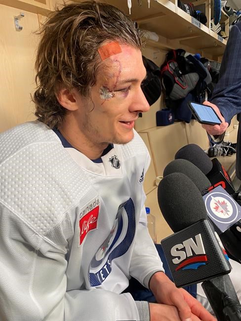 Jets forward Barron weighs in on recovery after taking skate to the face in Game 1 | iNFOnews.ca Jets forward Barron weighs in on recovery after taking skate to the face in Game 1 | iNFOnews.ca