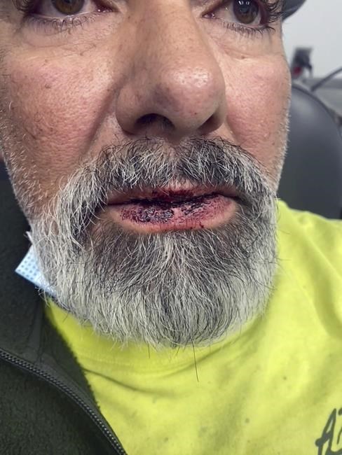 Colorado man stunned while handcuffed sues sheriff's office | iNFOnews.ca