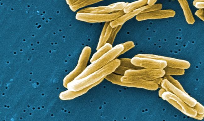 Tuberculosis outbreak declared in third Nunavut hamlet | iNFOnews.ca Tuberculosis outbreak declared in third Nunavut hamlet | iNFOnews.ca