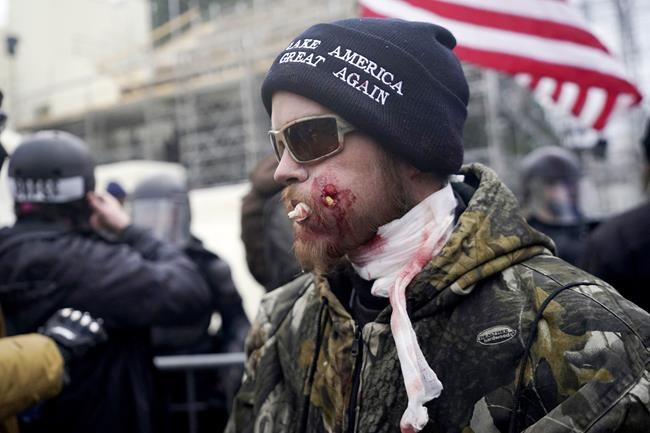 Wounded man who invaded Senate with knife sentenced to prison for Capitol riot | iNFOnews.ca CP242439974
