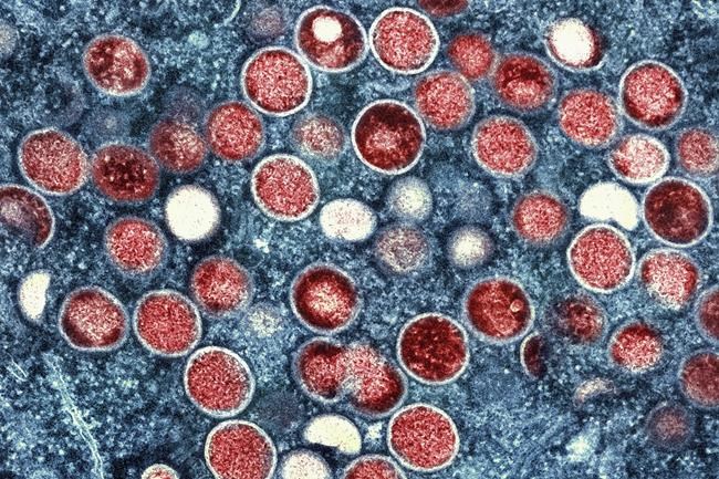 Mpox is down, but US cities could be at risk for summertime outbreaks | iNFOnews.ca Mpox is down, but US cities could be at risk for summertime outbreaks | iNFOnews.ca