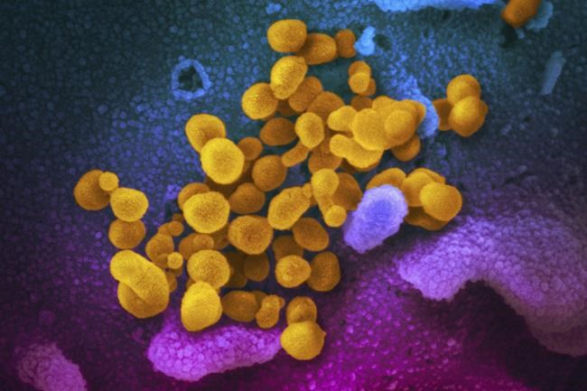 US study finds 1 in 10 get long COVID after omicron, starts identifying key symptoms | iNFOnews.ca US study finds 1 in 10 get long COVID after omicron, starts identifying key symptoms | iNFOnews.ca