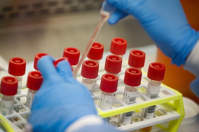 Confidence in science fell in 2022 while political divides persisted, poll shows | iNFOnews.ca Confidence in science fell in 2022 while political divides persisted, poll shows | iNFOnews.ca