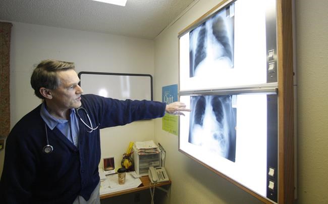Jury says health clinic in Montana Superfund town submitted 337 false asbestos claims | iNFOnews.ca Jury says health clinic in Montana Superfund town submitted 337 false asbestos claims | iNFOnews.ca