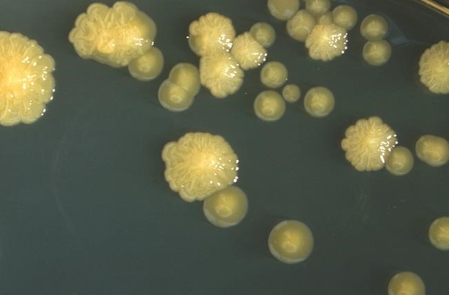 Deadly germ behind infant formula shortage joins CDC watchlist of bad bugs | iNFOnews.ca Deadly germ behind infant formula shortage joins CDC watchlist of bad bugs | iNFOnews.ca