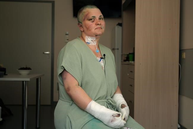 Russian journalist sustained a brain injury and fractures during a brutal beating in Chechnya | iNFOnews.ca