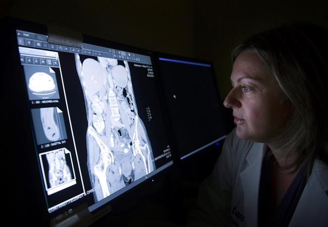 Groups want timely, accessible data on cancer to help improve outcomes | iNFOnews.ca Groups want timely, accessible data on cancer to help improve outcomes | iNFOnews.ca