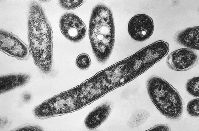 Legionnaires' disease outbreak in southeast Poland on decline with only 1 new case reported | iNFOnews.ca