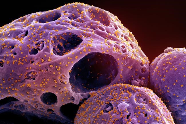 Mortality rose in 2021, led by cancer, heart disease, overdoses and COVID-19: StatCan | iNFOnews.ca Mortality rose in 2021, led by cancer, heart disease, overdoses and COVID-19: StatCan | iNFOnews.ca