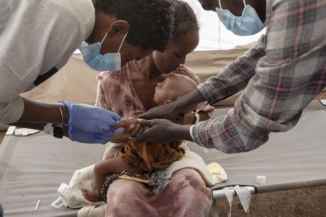 Researchers have verified 1,329 hunger deaths in Ethiopia's Tigray region since the cease-fire there | iNFOnews.ca Researchers have verified 1,329 hunger deaths in Ethiopia's Tigray region since the cease-fire there | iNFOnews.ca