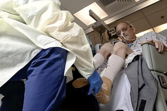 A month after a pig heart transplant, man works to regain strength with no rejection so far | iNFOnews.ca
