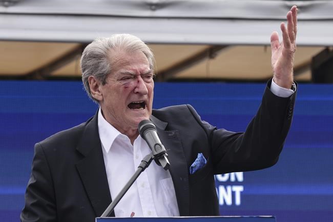 Former Albanian prime minister says he's charged with corruption and money laundering in land deal | iNFOnews.ca Former Albanian prime minister says he's charged with corruption and money laundering in land deal | iNFOnews.ca