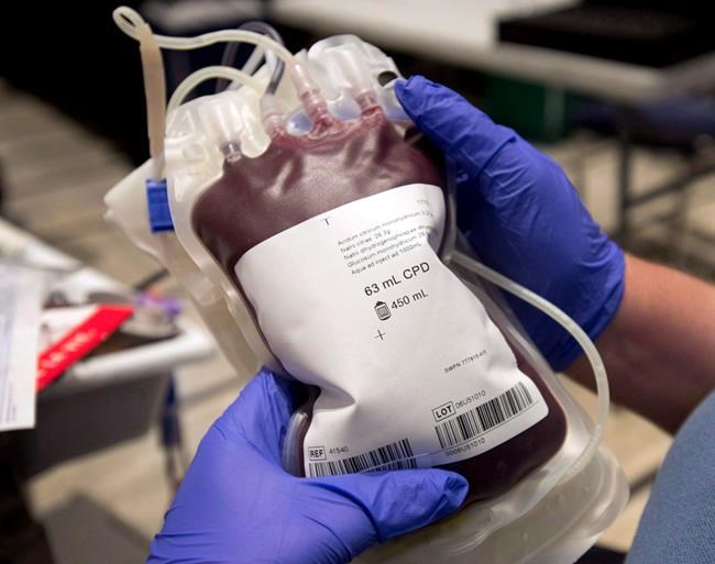 Health Canada approves nationwide removal of blood donor ban sparked by mad cow fears | iNFOnews.ca