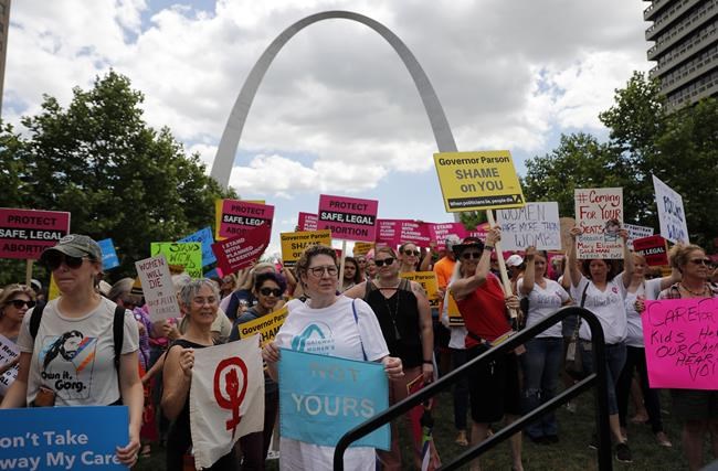 Missouri lawmakers propose allowing homicide charges for women who have abortions | iNFOnews.ca Missouri lawmakers propose allowing homicide charges for women who have abortions | iNFOnews.ca