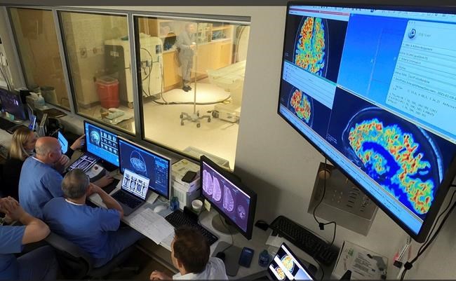 Alzheimer's drugs might get into the brain faster with new ultrasound tool, study shows | iNFOnews.ca Alzheimer's drugs might get into the brain faster with new ultrasound tool, study shows | iNFOnews.ca