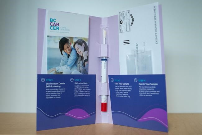 Cancer society, gynecologists hope for national shift in cervical cancer screening | iNFOnews.ca Cancer society, gynecologists hope for national shift in cervical cancer screening | iNFOnews.ca