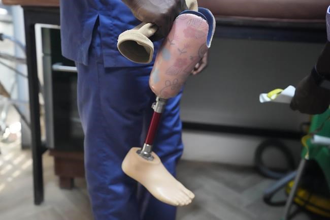 Nigerian group provides hundreds of prosthetic limbs to amputee children thanks to crowdfunding | iNFOnews.ca