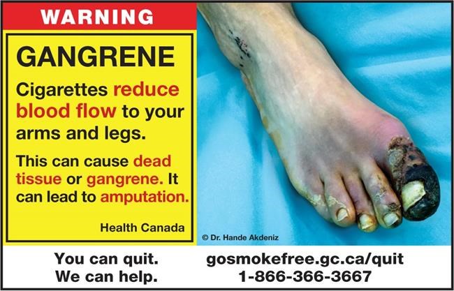New graphic health warnings on cigarette packs aim to help smokers kick the habit | iNFOnews.ca