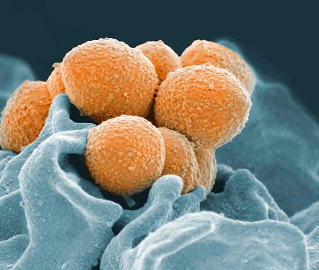 Get flu shot to limit risk of rare cases of invasive, deadly strep A: doctor | iNFOnews.ca