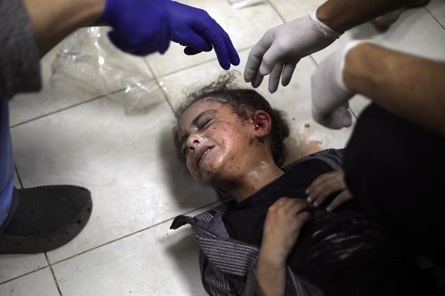 UN: Palestinians are dying in hospitals as estimated 60,000 wounded overwhelm remaining doctors | iNFOnews.ca UN: Palestinians are dying in hospitals as estimated 60,000 wounded overwhelm remaining doctors | iNFOnews.ca