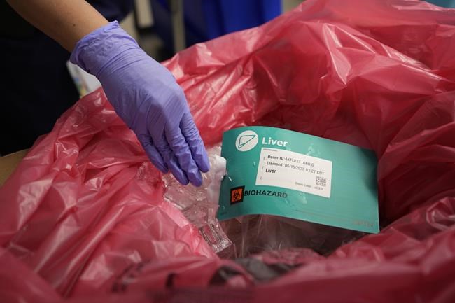 More Quebecers donated organs after MAID but Canada needs standardized data: study | iNFOnews.ca More Quebecers donated organs after MAID but Canada needs standardized data: study | iNFOnews.ca