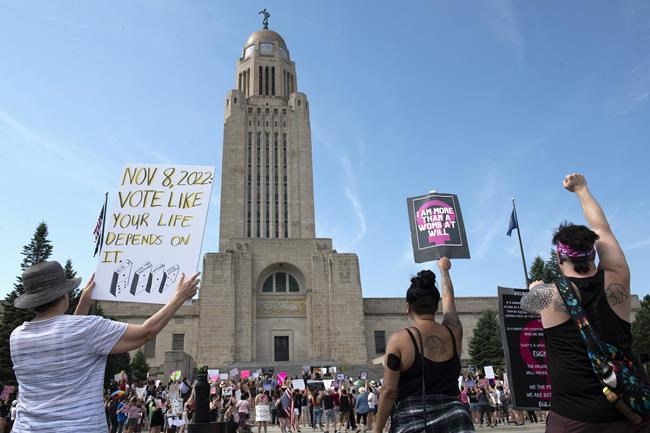 Nebraska Republican gives top priority to bill allowing abortions in cases of fatal fetal anomalies | iNFOnews.ca Nebraska Republican gives top priority to bill allowing abortions in cases of fatal fetal anomalies | iNFOnews.ca