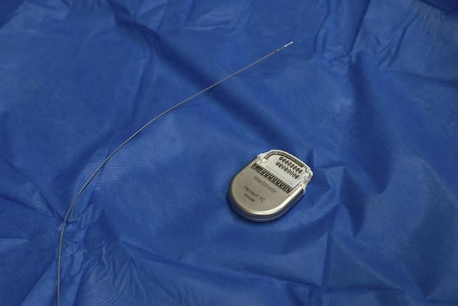 A pacemaker for the brain helped a woman with crippling depression. It may soon offer hope to others | iNFOnews.ca