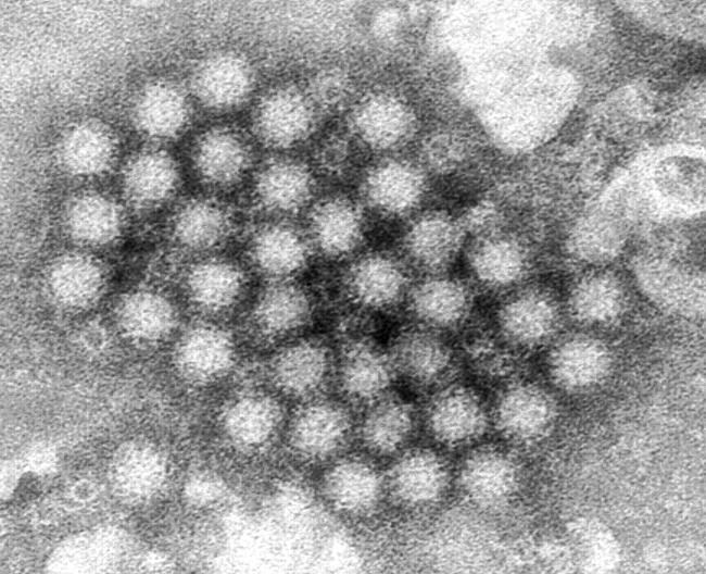 Norovirus illnesses are up in some places. Here's what you need to know | iNFOnews.ca Norovirus illnesses are up in some places. Here's what you need to know | iNFOnews.ca